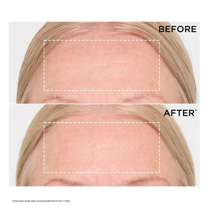 Double Serum