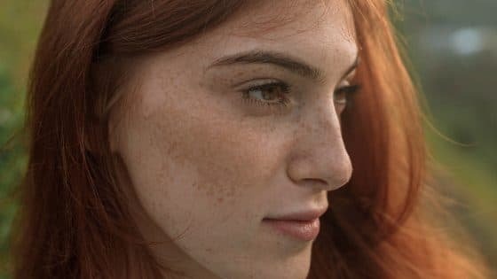 Sebaceous Filaments vs Blackheads: What’s The Difference? Sebaceous Filaments vs Blackheads: What’s The Difference?