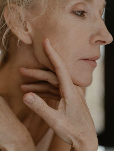 Old woman with age spots Old woman with age spots