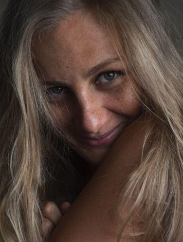 woman with age spots woman with age spots